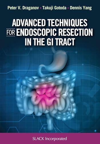 Stock image for Advanced Techniques for Endoscopic Resection in the GI Tract for sale by GoldenWavesOfBooks