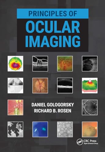 Imagen de archivo de Principles of Ocular Imaging a la venta por Open Books