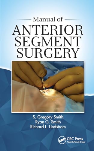 Stock image for Manual of Antterior Segment Surgery [Soft Cover ] for sale by booksXpress