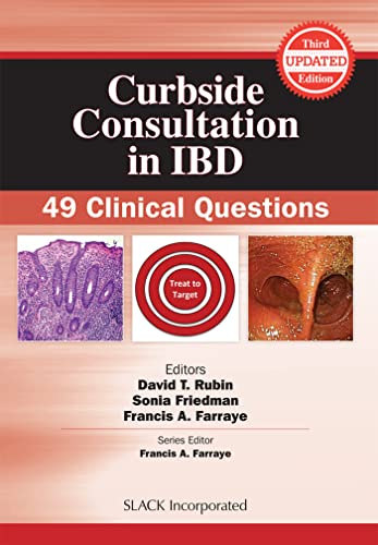 Beispielbild fr Curbside Consultation in IBD zum Verkauf von Blackwell's