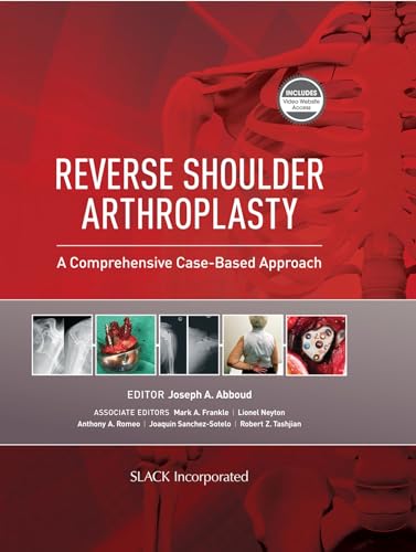 Stock image for Reverse Shoulder Arthroplasty: A Comprehensive Case-Based Approach for sale by Revaluation Books