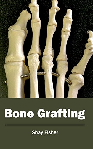 9781632410603: Bone Grafting