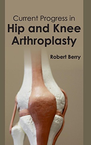 Beispielbild fr Current Progress in Hip and Knee Arthroplasty zum Verkauf von Buchpark
