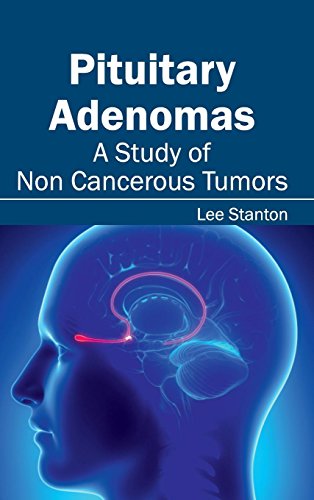 Beispielbild fr Pituitary Adenomas: A Study of Non Cancerous Tumors zum Verkauf von Ria Christie Collections
