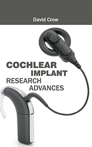 Beispielbild fr Cochlear Implant Research Advances zum Verkauf von Buchpark