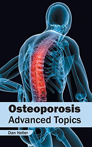 Stock image for Osteoporosis: Advanced Topics for sale by Romtrade Corp.