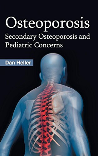 Stock image for Osteoporosis: Secondary Osteoporosis and Pediatric Concerns for sale by Romtrade Corp.