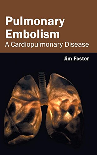 Beispielbild fr Pulmonary Embolism: A Cardiopulmonary Disease zum Verkauf von Buchpark