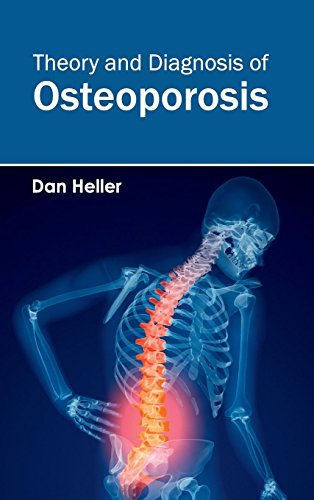 Stock image for Theory and Diagnosis of Osteoporosis for sale by Romtrade Corp.