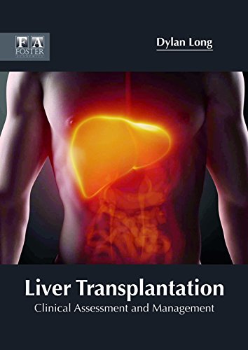 Stock image for Liver Transplantation: Clinical Assessment and Management for sale by Romtrade Corp.
