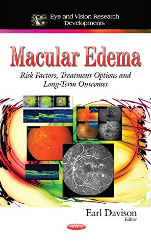9781633215849: Macular Edema: Risk Factors, Treatment Options and Long-Term Outcomes (Eye and Vision Research Developments)