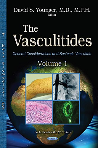 9781634631105: The Vasculitidies: General Considerations and Systemic Vasculitis: Volume 1 -- General Considerations & Systemic Vasculitis