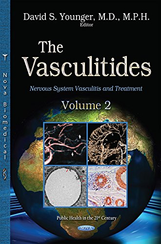 Stock image for The Vasculitidies, Volume 2 Volume 2 Nervous System Vasculitis Treatment Public Health in the 21st Cent for sale by PBShop.store US