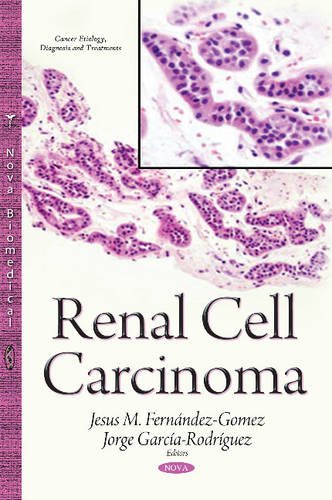 9781634824958: Renal Cell Carcinoma