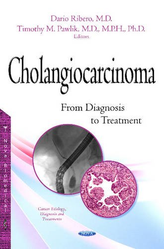 9781634834889: Cholangiocarcinoma: From Diagnosis to Treatment