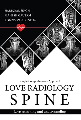 Imagen de archivo de Love Radiology Spine a la venta por GF Books, Inc.