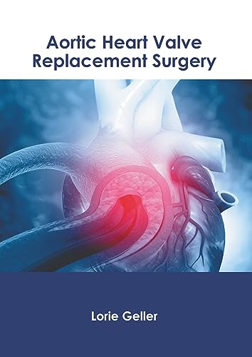 9781639278930: Aortic Heart Valve Replacement Surgery