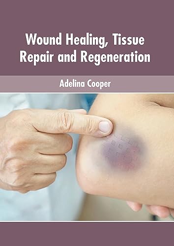 Stock image for Wound Healing, Tissue Repair and Regeneration for sale by Romtrade Corp.