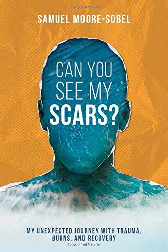 Beispielbild fr Can You See My Scars? zum Verkauf von Better World Books