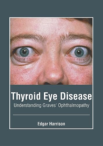Stock image for Thyroid Eye Disease: Understanding Graves' Ophthalmopathy for sale by Revaluation Books