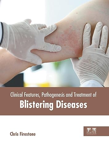 9781646465903: Clinical Features, Pathogenesis and Treatment of Blistering Diseases