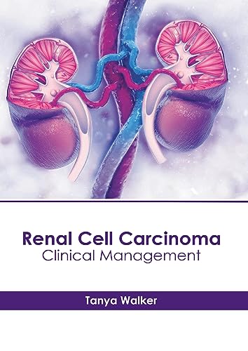 Beispielbild fr Renal Cell Carcinoma: Clinical Management zum Verkauf von Romtrade Corp.