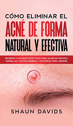 Beispielbild fr C mo Eliminar el Acn de Forma Natural y Efectiva: Remedios altamente efectivos para eliminar granos, espinillas, puntos negros y cicatrices para siempre (Spanish Edition) zum Verkauf von PlumCircle