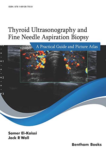 Stock image for Thyroid Ultrasonography and Fine Needle Aspiration Biopsy: A Practical Guide and Picture Atlas for sale by Lucky's Textbooks