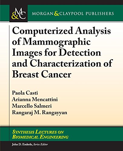 Imagen de archivo de Computerized Analysis of Mammographic Images for Detection and Characterization of Breast Cancer (Synthesis Lectures on Biomedical Engineering) a la venta por BOOKWEST