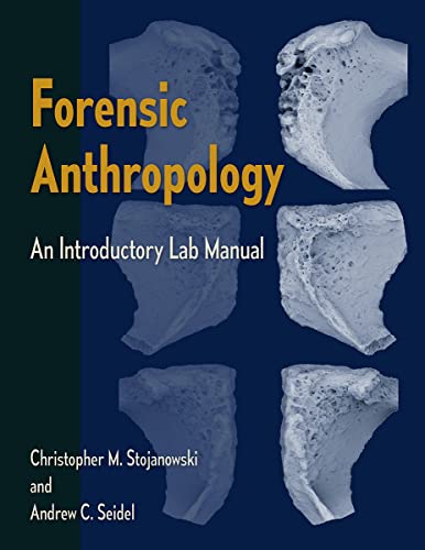 Stock image for Forensic Anthropology: An Introductory Lab Manual for sale by A Team Books