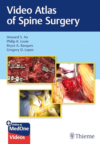 Beispielbild fr Video Atlas of Spine Surgery zum Verkauf von Blackwell's