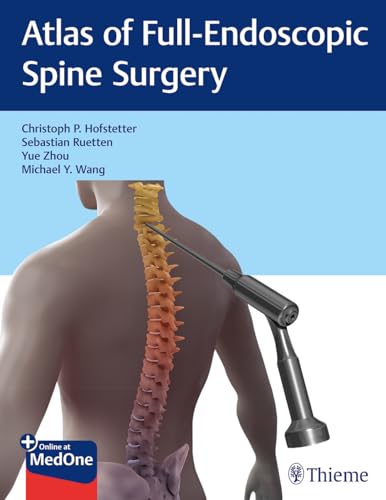 Beispielbild fr Atlas of Full-Endoscopic Spine Surgery zum Verkauf von Blackwell's