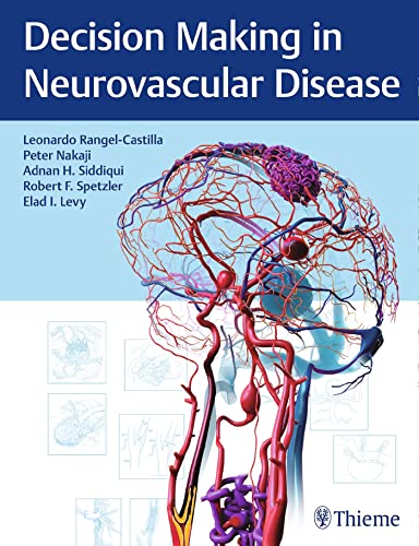Imagen de archivo de Decision Making in Neurovascular Disease a la venta por GF Books, Inc.