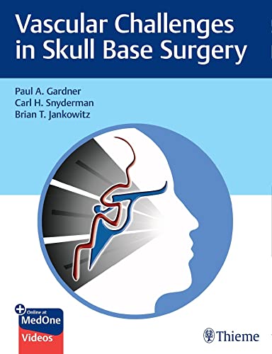 Beispielbild fr Vascular Challenges in Skull Base Surgery zum Verkauf von Blackwell's