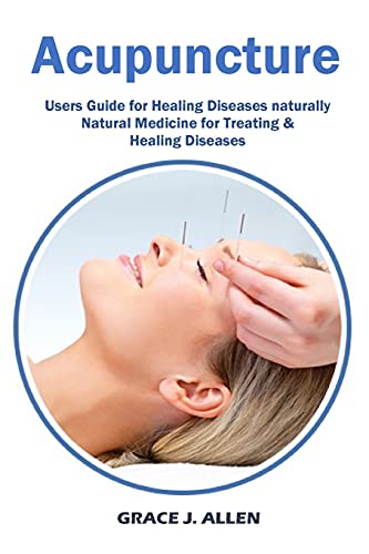 Stock image for Acupuncture: Users Guide for Healing Diseases naturally Natural Medicine for Treating & Healing Diseases for sale by GreatBookPrices