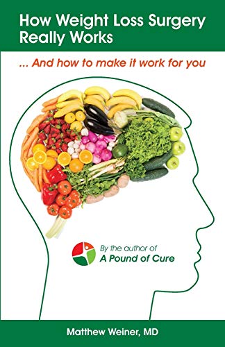 9781688128804: How Weight Loss Surgery Really Works: And How to Make it Work for You