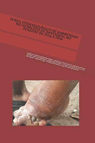 Beispielbild fr PERFIL EPIDEMIOLGICO DE HANSENASE NO MUNICPIO DE SANTARM, NO PERODO DE 2013 A 2016 zum Verkauf von Revaluation Books
