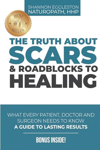 Stock image for The Truth About Scars and Roadblocks to Healing: What Every Patient, Doctor, and Surgeon Needs to Know for sale by KuleliBooks