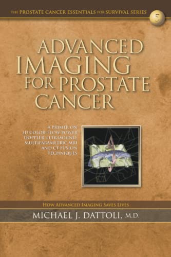 Stock image for Advanced Imaging for Prostate Cancer: A Primer on 3D Color-Flow Power Doppler Ultrasound, Multiparametric MRI and CT Fusion Techniques for sale by THE SAINT BOOKSTORE