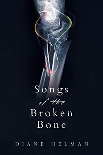 Stock image for Songs of the Broken Bone for sale by Wonder Book