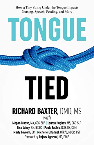 Beispielbild fr Tongue-Tied: How a Tiny String Under the Tongue Impacts Nursing, Speech, Feeding, and More zum Verkauf von BooksRun