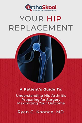 Stock image for Your Hip Replacement: A Patients Guide To: Understanding Hip Arthritis, Preparing for Surgery, Maximizing Your Outcome for sale by Goodwill of Colorado