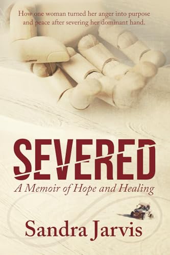 Imagen de archivo de Severed: A Memoir of Hope and Healing a la venta por SecondSale