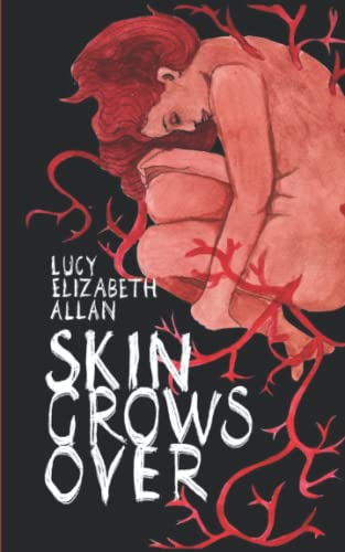 Stock image for Skin Grows Over for sale by Bookmans