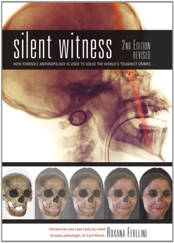 9781770851184: Silent Witness: How Forensic Anthropology is Used to Solve the World's Toughest Crimes