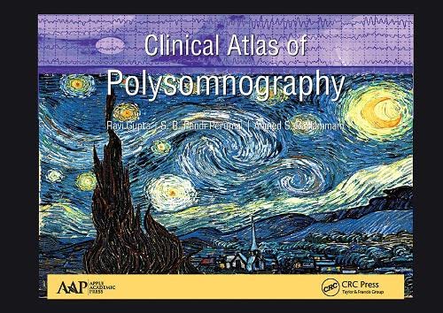 Stock image for Clinical Atlas of Polysomnography for sale by Blackwell's