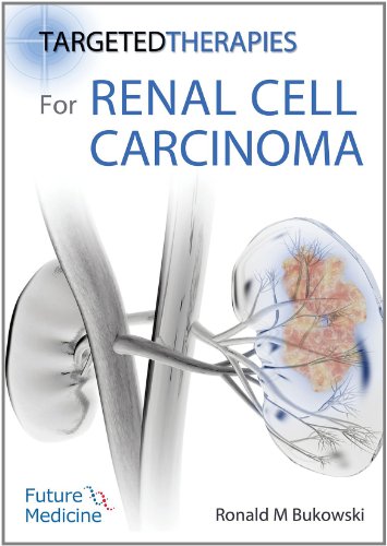 Beispielbild fr Targeted Therapies for Renal Cell Carcinoma zum Verkauf von Revaluation Books