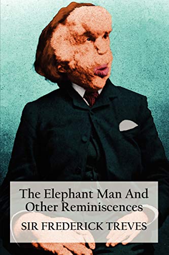 Beispielbild fr The Elephant Man and Other Reminiscences zum Verkauf von WorldofBooks