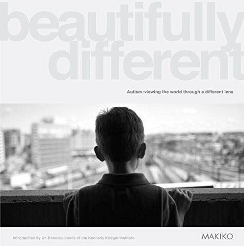 9781783063895: Beautifully Different: Autism: viewing the world through a different lens