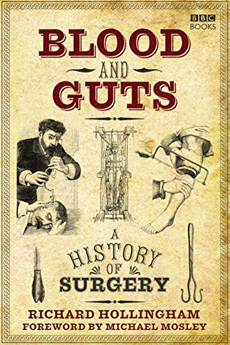 Beispielbild fr Blood and Guts: A History of Surgery zum Verkauf von WorldofBooks